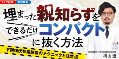 埋まった親知らずをできるだけコンパクトに抜く方法